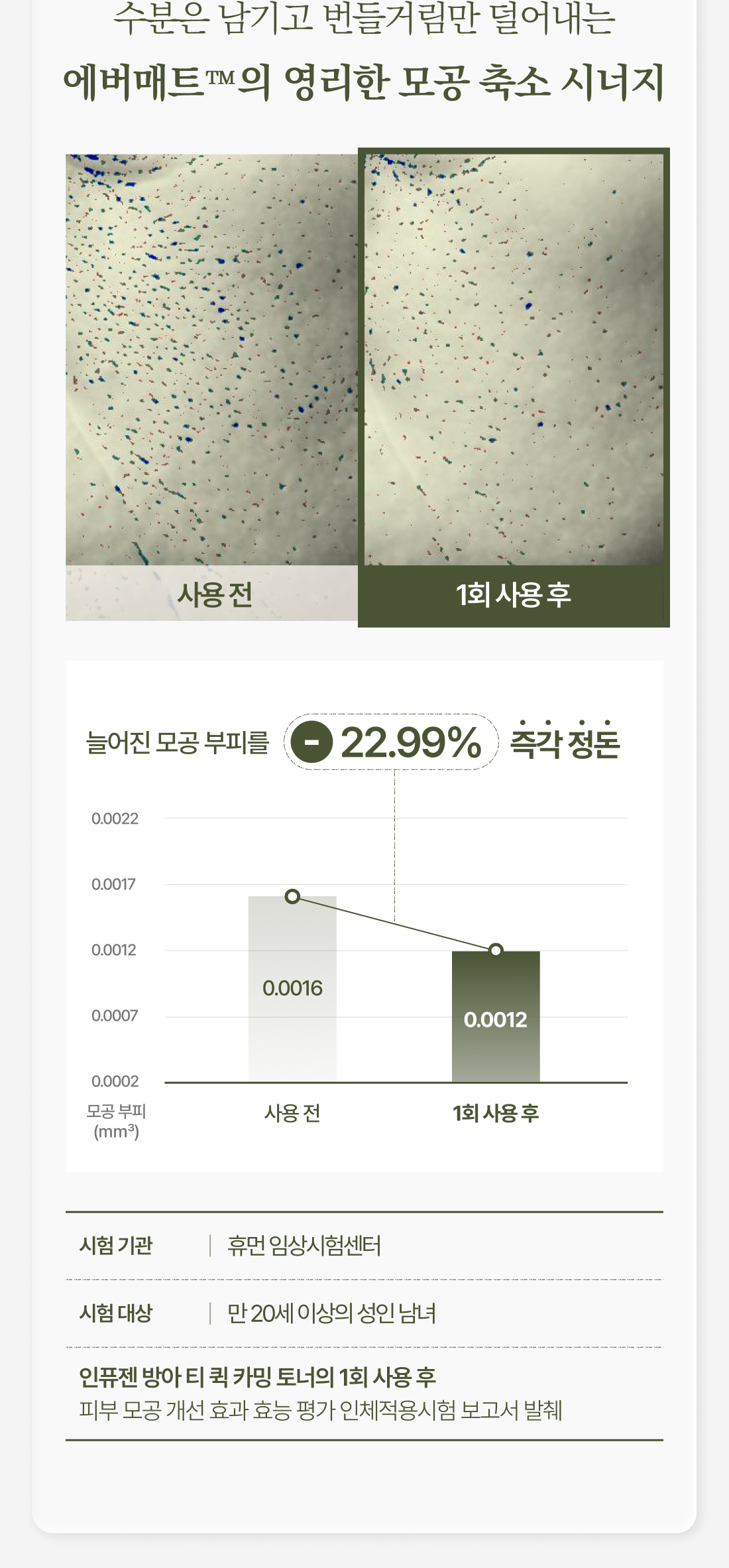 Pore microscopy clinical data — pore volume reduction